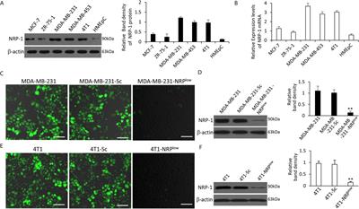 The miR-124-3p/Neuropilin-1 Axis Contributes to the Proliferation and Metastasis of Triple-Negative Breast Cancer Cells and Co-Activates the TGF-β Pathway